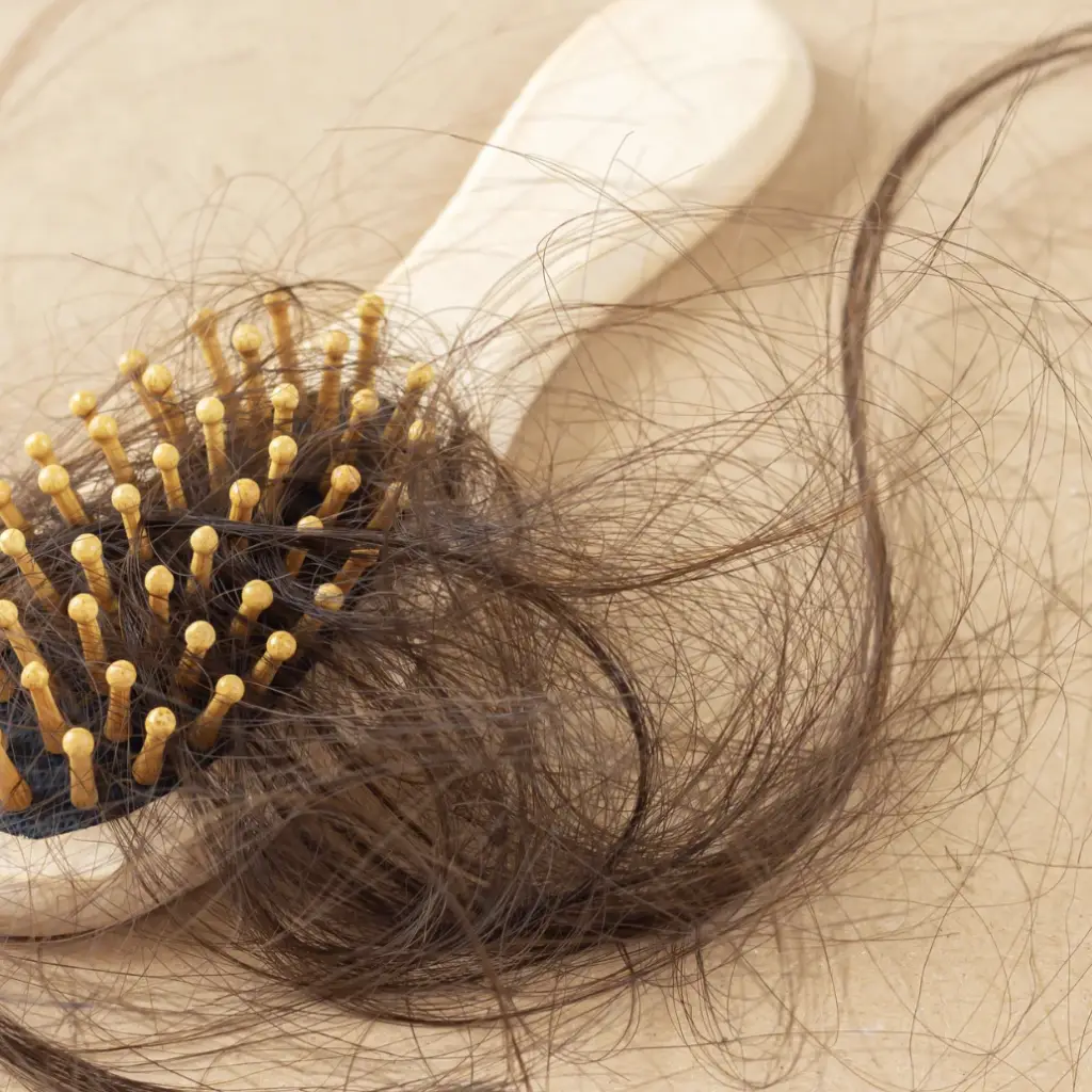 Queda de cabelo, cansaço, sintomas persistentes de hipotireoidismo